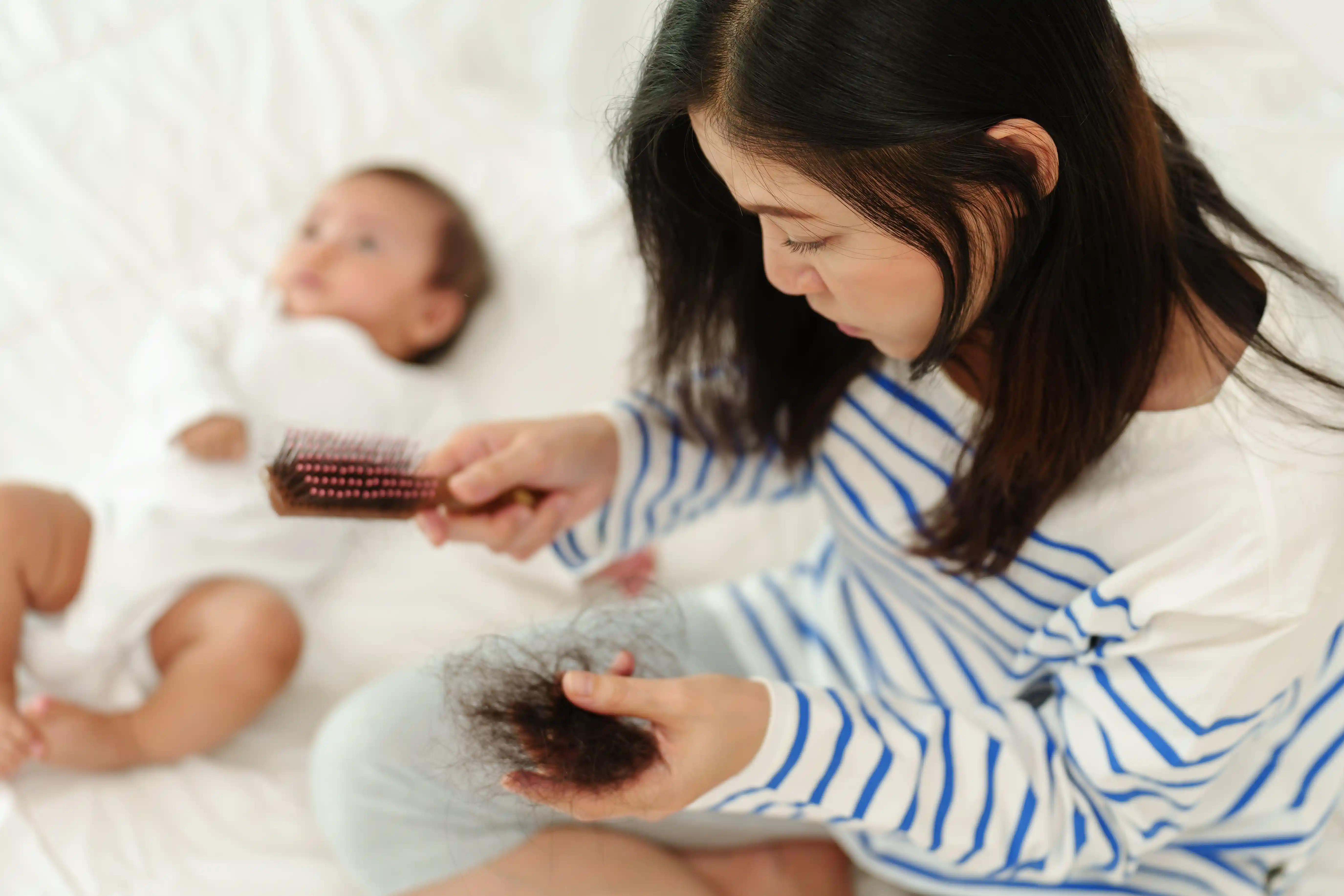 Postpartum Hair Loss Treatment